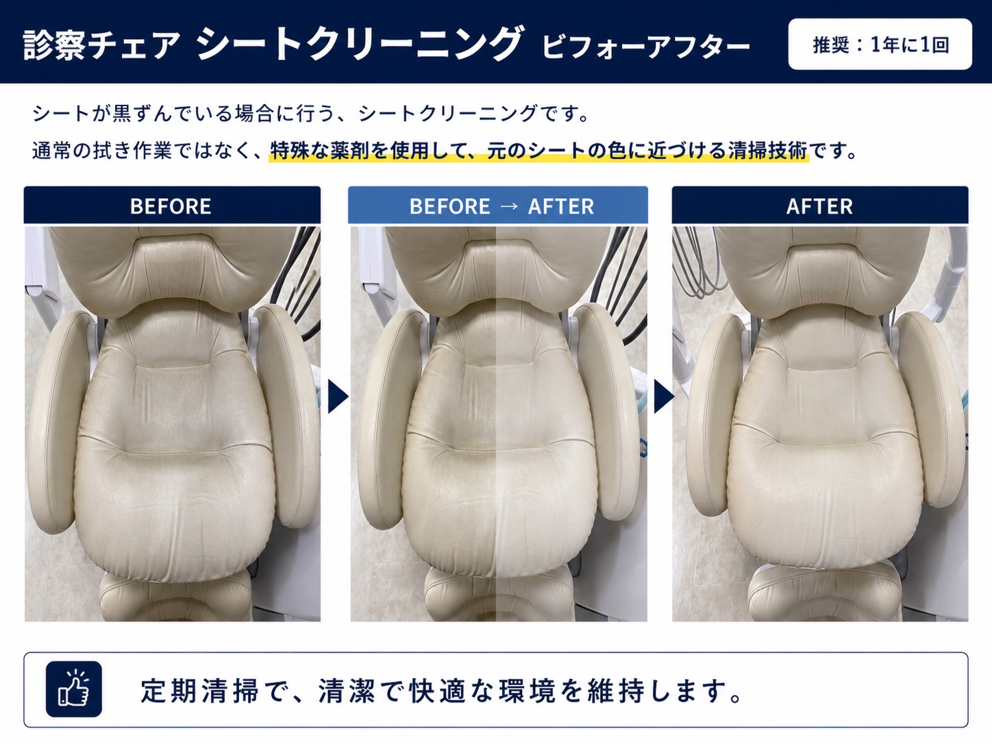 ユニットのシートクリーニング